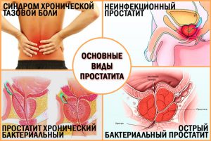 retenție urinară acută cu tratamentul prostatitei infectia tractului urinar