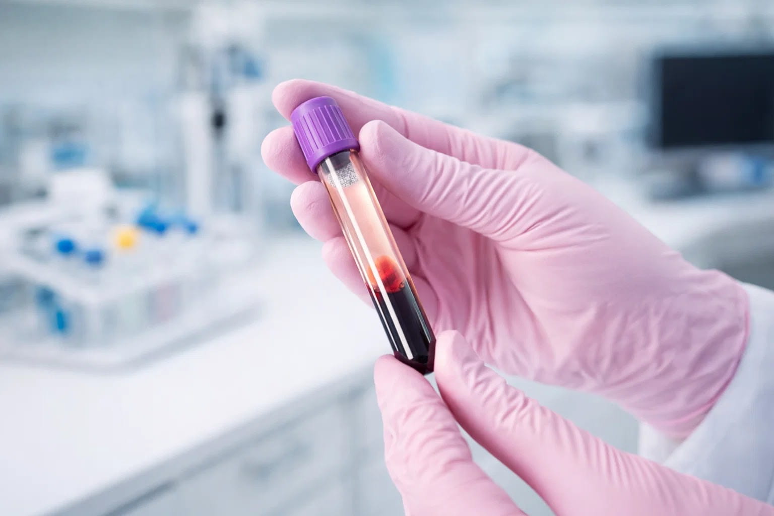 Рука в перчатке держит пробирку для лабораторной диагностики на индекс здоровья простаты PHI.
